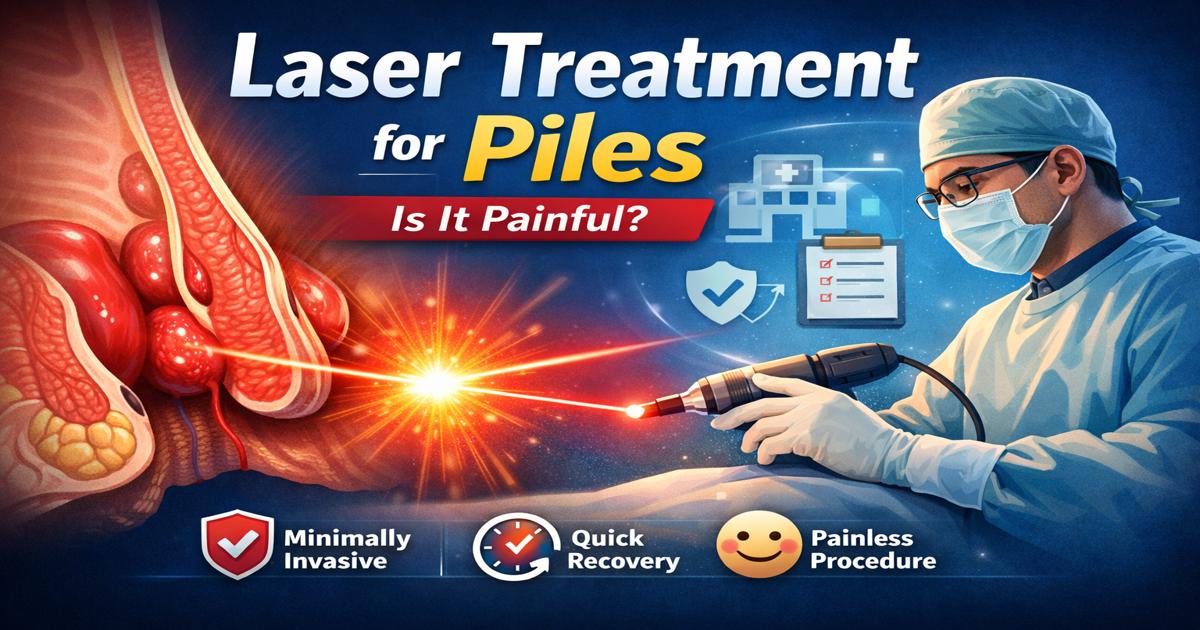 What Is Laser Treatment for Piles? Is It Painful?